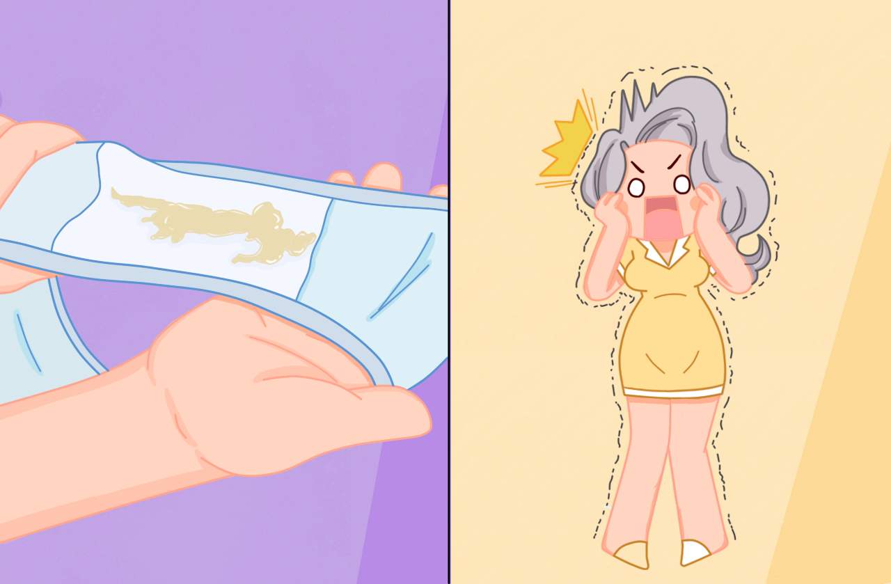 女性阴道疾病生理科普,科普女性炎症是什么造成的