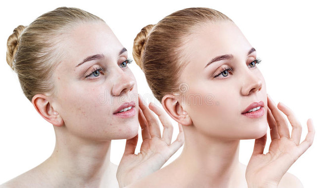 美白保湿面霜正品老牌子,平价好用的美白面霜