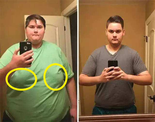 胸部下垂脂肪少如何让胸部增大,男性胸部下垂还能练出来吗