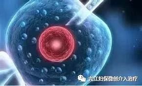 倪海厦治疗输卵管堵塞,输卵管堵塞该如何治疗