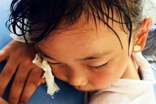 夏季宝宝身上擦爽身粉,宝宝身上痱子痒怎么解决