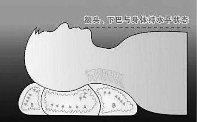 颈椎病枕热水袋睡觉行吗,颈椎病枕啤酒瓶可以整夜睡觉吗