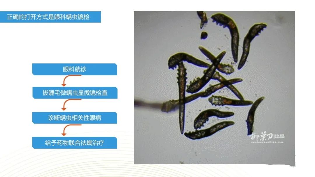 眼睛总是痒？总感觉眼睛里有东西？结膜炎角膜炎反反复复？可能是你的眼睛里有螨虫