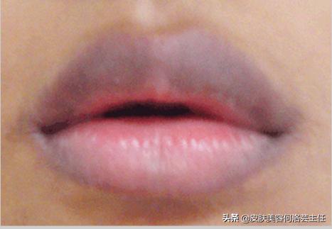 为什么早起唇色深晚上唇色浅,唇色深和唇色暗的对比