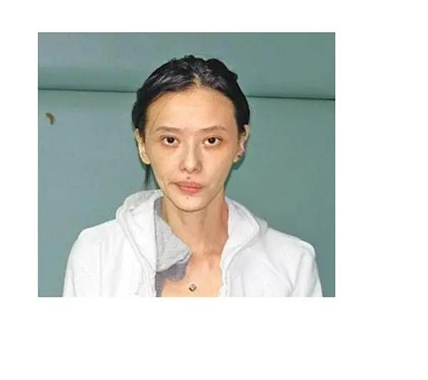 郑爽15年后发生了什么？黑眼圈、暴瘦、畏光、精神失控，就像吸毒