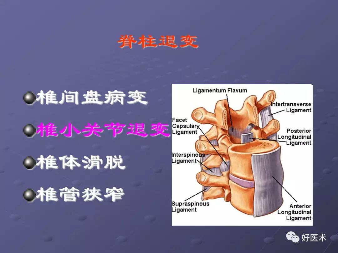 脊柱mri有哪些特点,乳腺疾病的mri诊断及鉴别