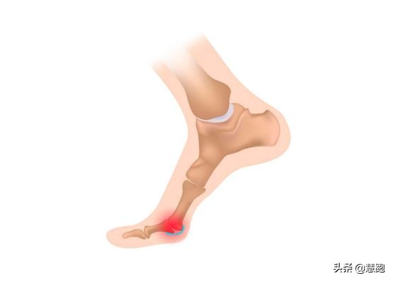 鞋舒不舒服只有脚知道下一句,鞋舒不舒服只有脚知道