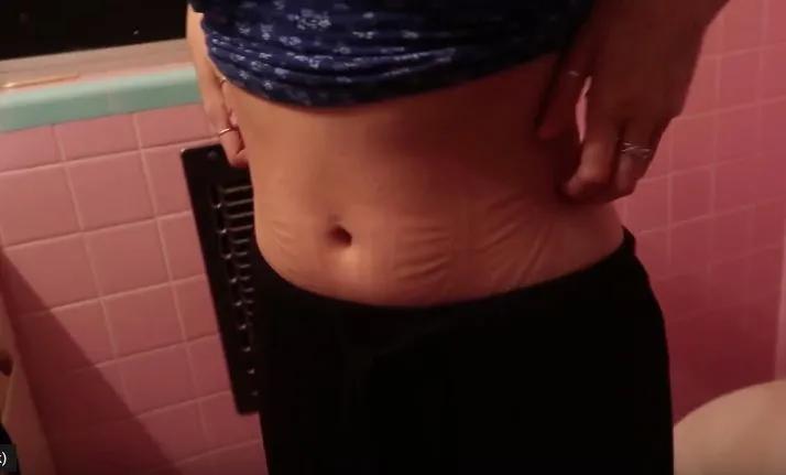 “内脏下垂、子宫脱落、漏尿”：扒一扒你不知道的网红束腰