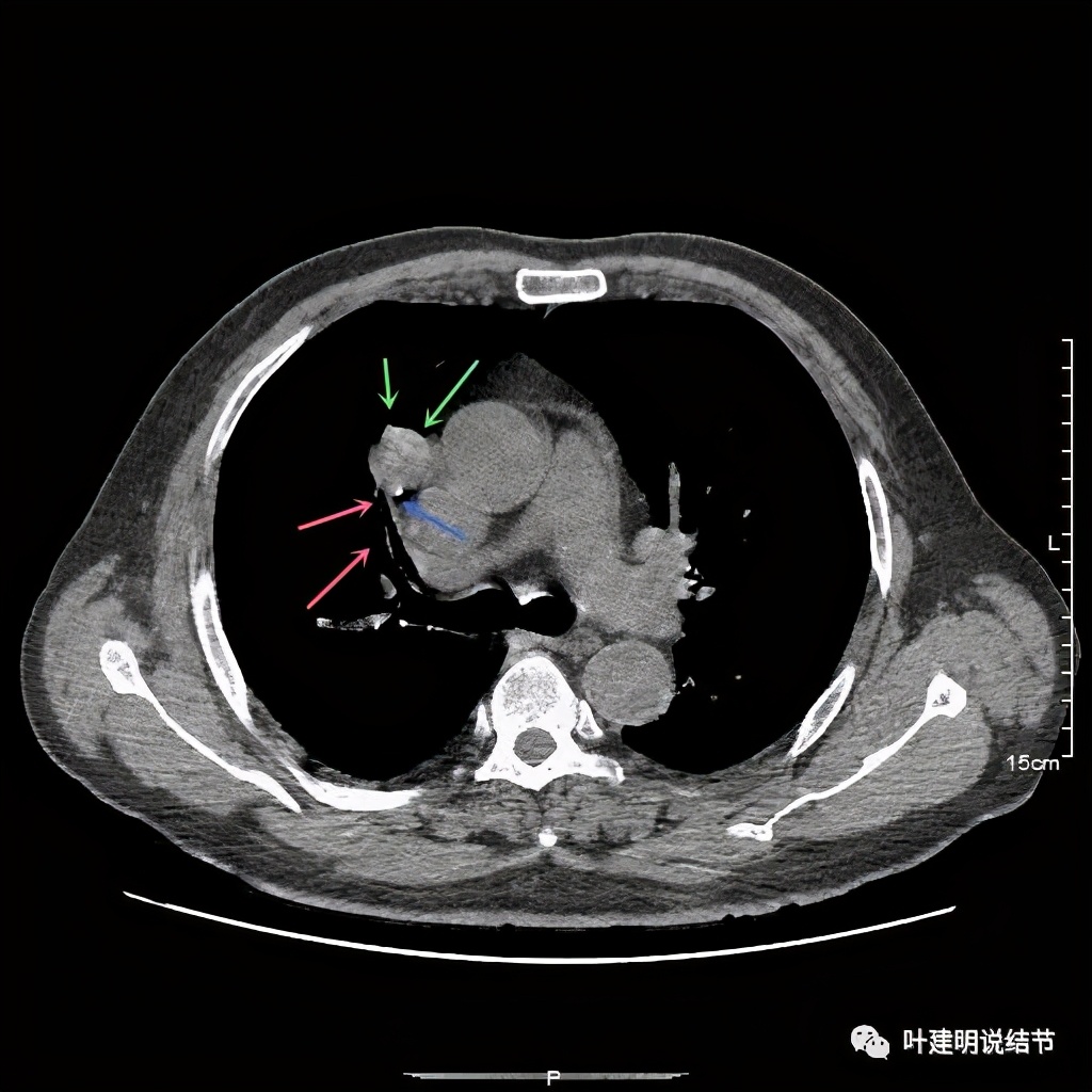 误诊报告图片,误诊案例及案例分析