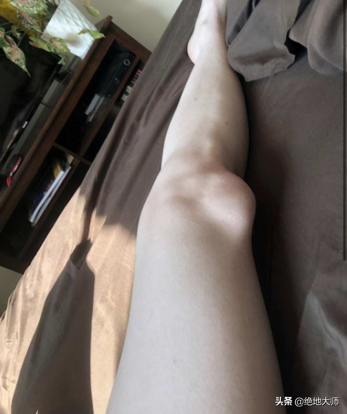 膝关节疼痛用神经阻断疗法,膝关节的疼痛与治疗综述