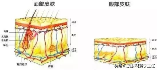 黑眼圈用中医治疗法,黑眼圈的分型和对症治疗