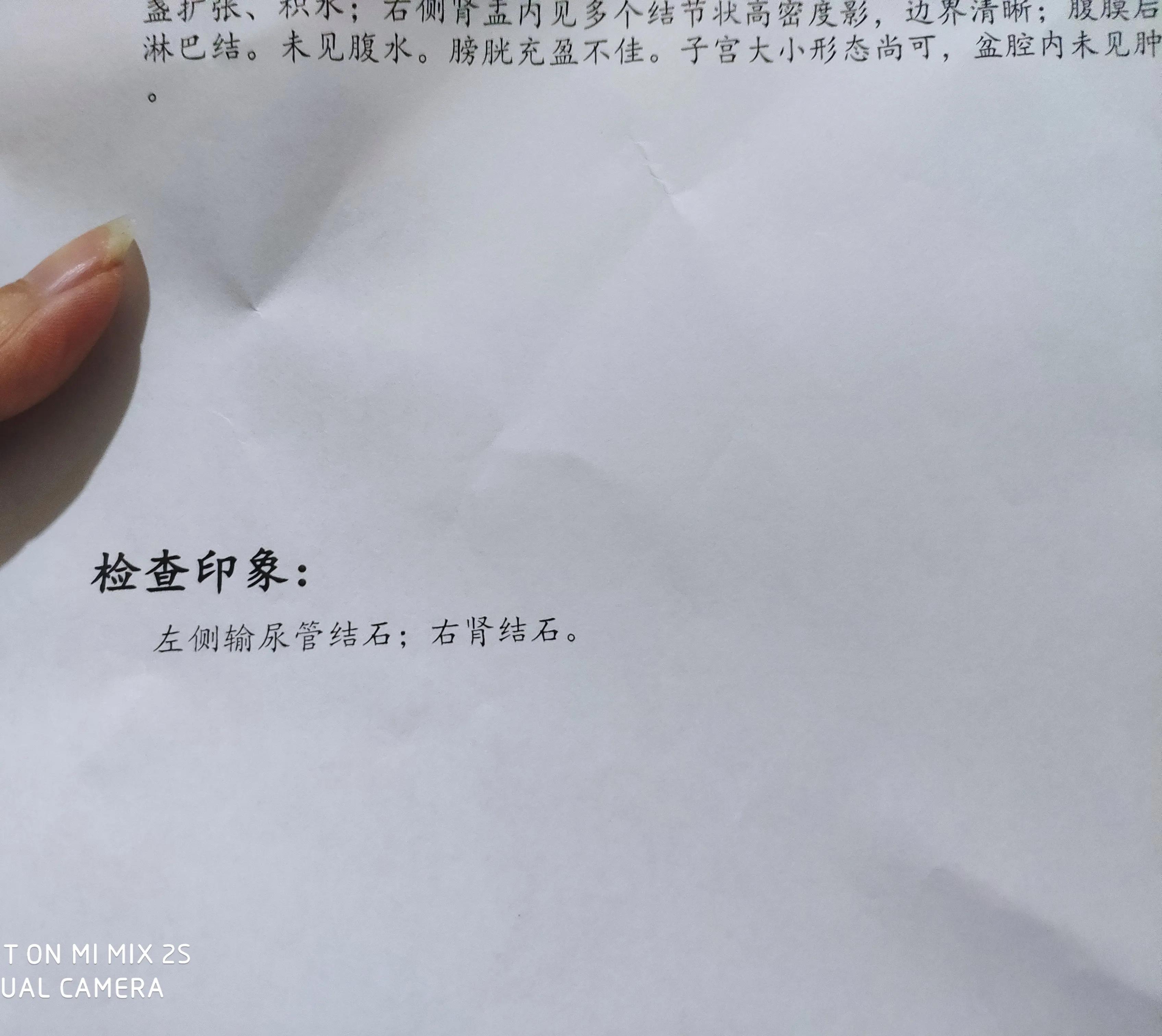 上班途中结石突然疼痛,左腹痛恶心呕吐一定是结石吗