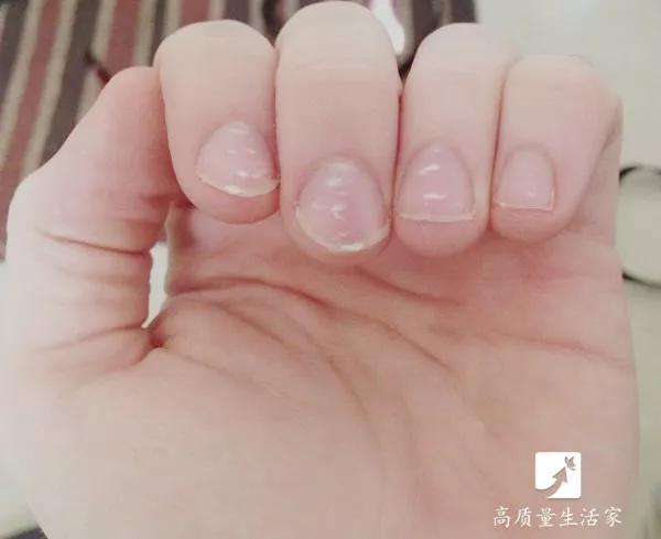 指甲半月牙少是怎么回事,指甲上月牙少是不是身体不好