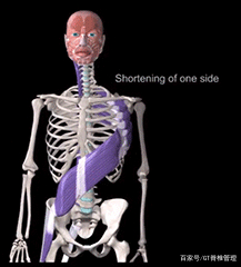 产后骨盆错位矫正办法,骨盆旋转错位怎么恢复