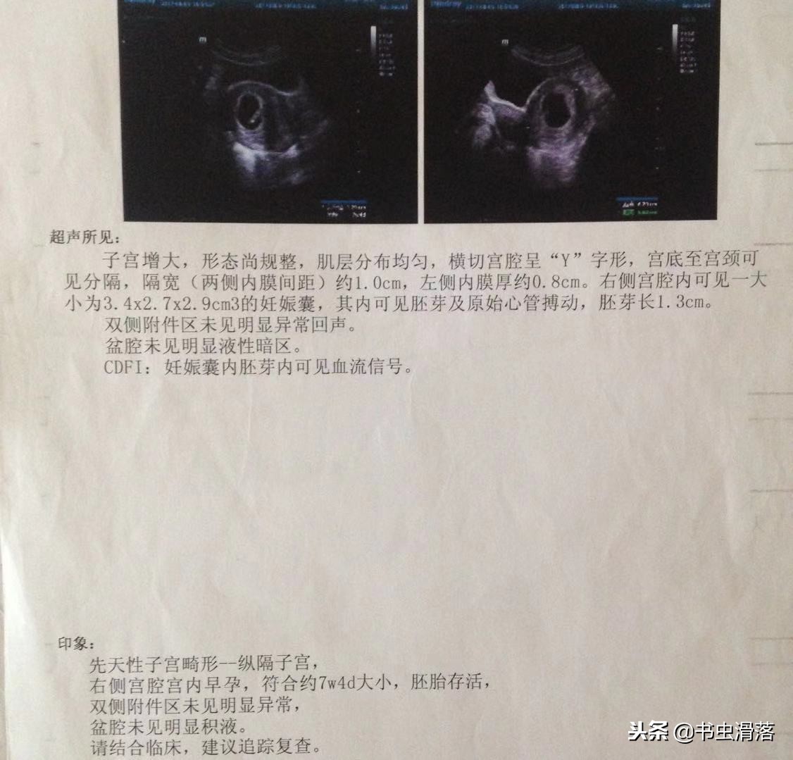 纵隔子宫可以手术吗,纵隔子宫如何备孕