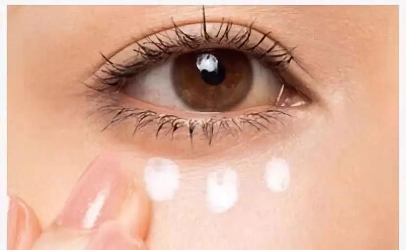 名门泽佳怎么消除黑眼圈,名门泽佳去眼袋是真是假