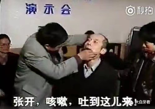 周德荣气功拔牙是怎样骗人的？正规的拔牙流程戳这里