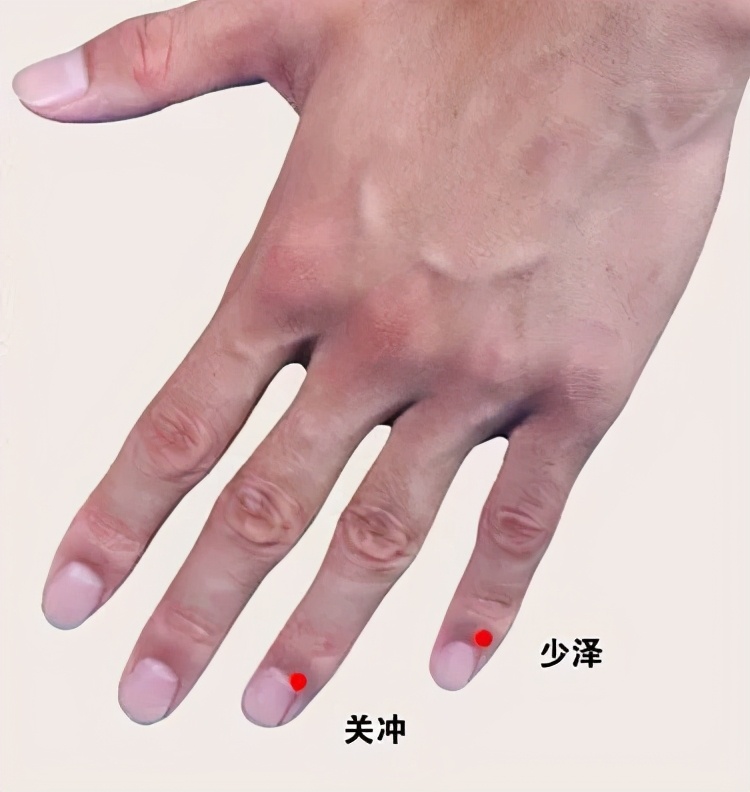 宝宝湿疹应该忌口什么,外阴湿疹好了以后还用忌口吗