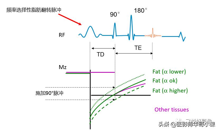 飞利浦磁共振独有技术,飞利浦磁共振减影技术