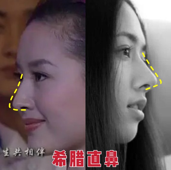 好看的鼻子类型驼峰鼻,好看的鼻型有哪几种