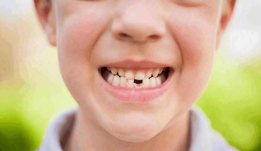 孩子乳牙别扔掉关键时能救命,乳牙千万不要硬拔