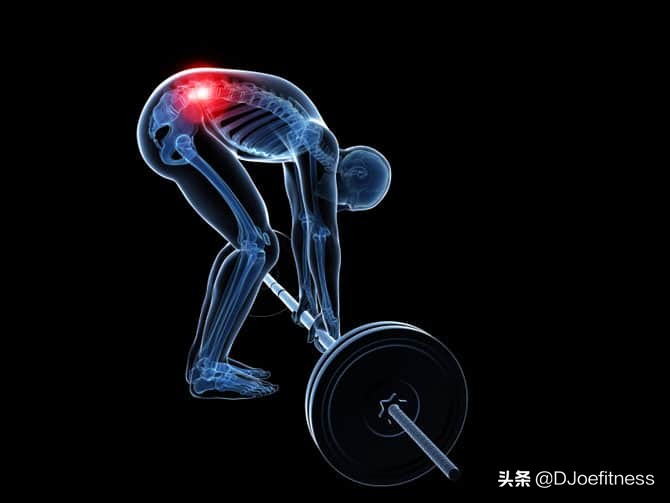 腰部损伤能好吗,腰受伤了以后还能做硬拉吗