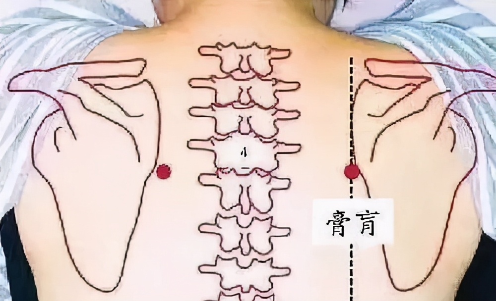 肩颈酸痛的穴位解决方法,缓解肩颈酸痛最有效的运动