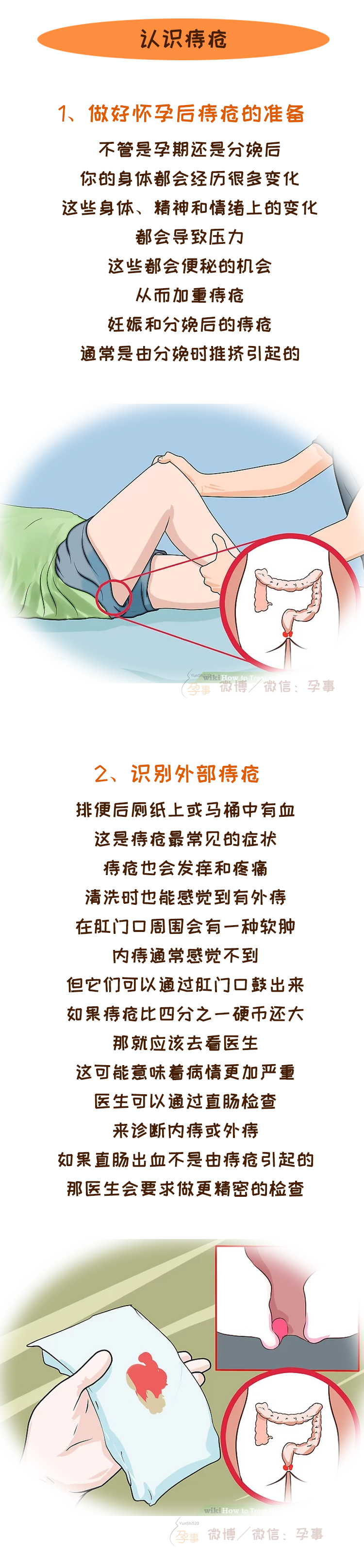 产后痔疮脱出严重肿大疼痛怎么办,产后痔疮大便干燥拉不出来怎么办