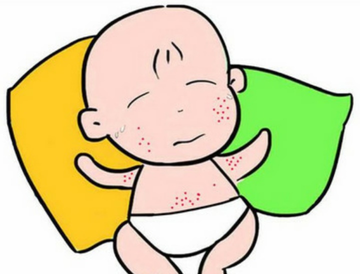 秋季容易捂出痱子如何治疗秋痱,大暑痱子