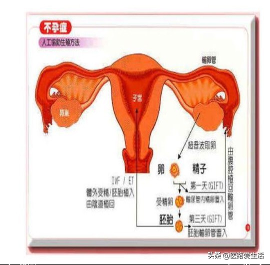 女人不孕迟早离婚,女人不孕大多会离婚吗