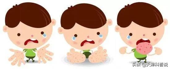 手足口病高发期!这九个问题你都知道吗?