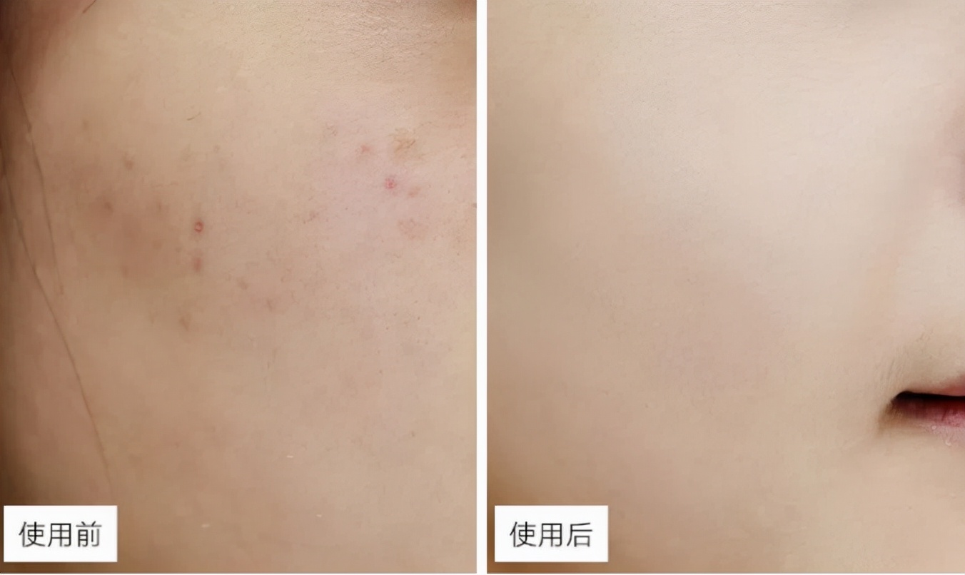 国外比国内火的护肤品,国外卖得比中国便宜的国产品牌