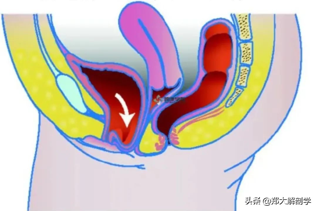 女性盆底功能障碍性疾病表现,南通治疗盆底功能障碍的医院