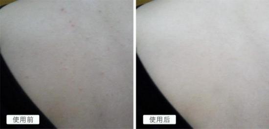 日本去螨虫皂,日本小黑皂号称螨虫克星