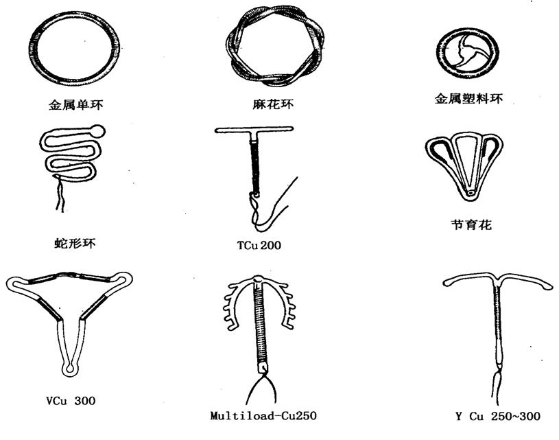“上环”避孕这11个问题要知道，科学避孕，别让“误区”害了你