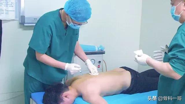 强直6年绝望自杀！在家人逼迫下，做出选择，竟然驼背也挺直了