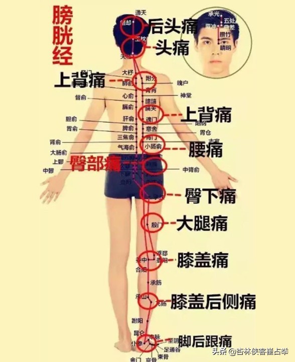 痛症总论——痛点不固定、全身痛、全身肌肉痛,三步走帮你改善