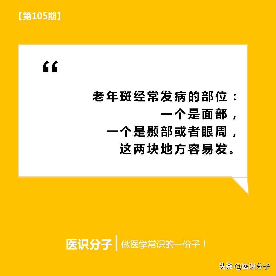年轻人长老年斑能激光去除吗,激光老年斑最真实的经历