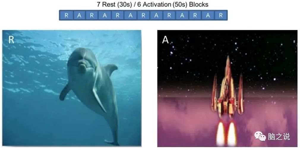 ADHD右侧额下回皮层fMRI神经反馈的功能连接变化