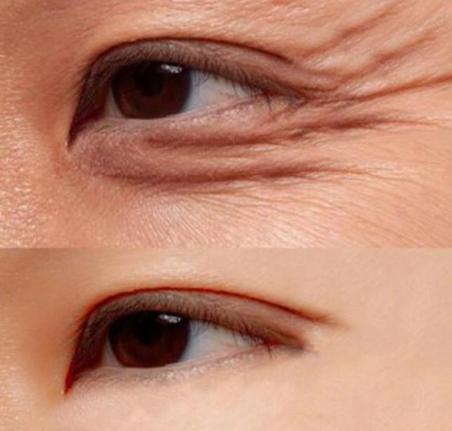 19岁显老该用什么护肤品价格便宜,脸部显老用护肤品可以改善吗