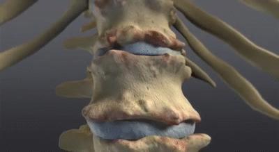 背部内侧疼痛怎么解决男性,年轻男性右侧背部疼痛