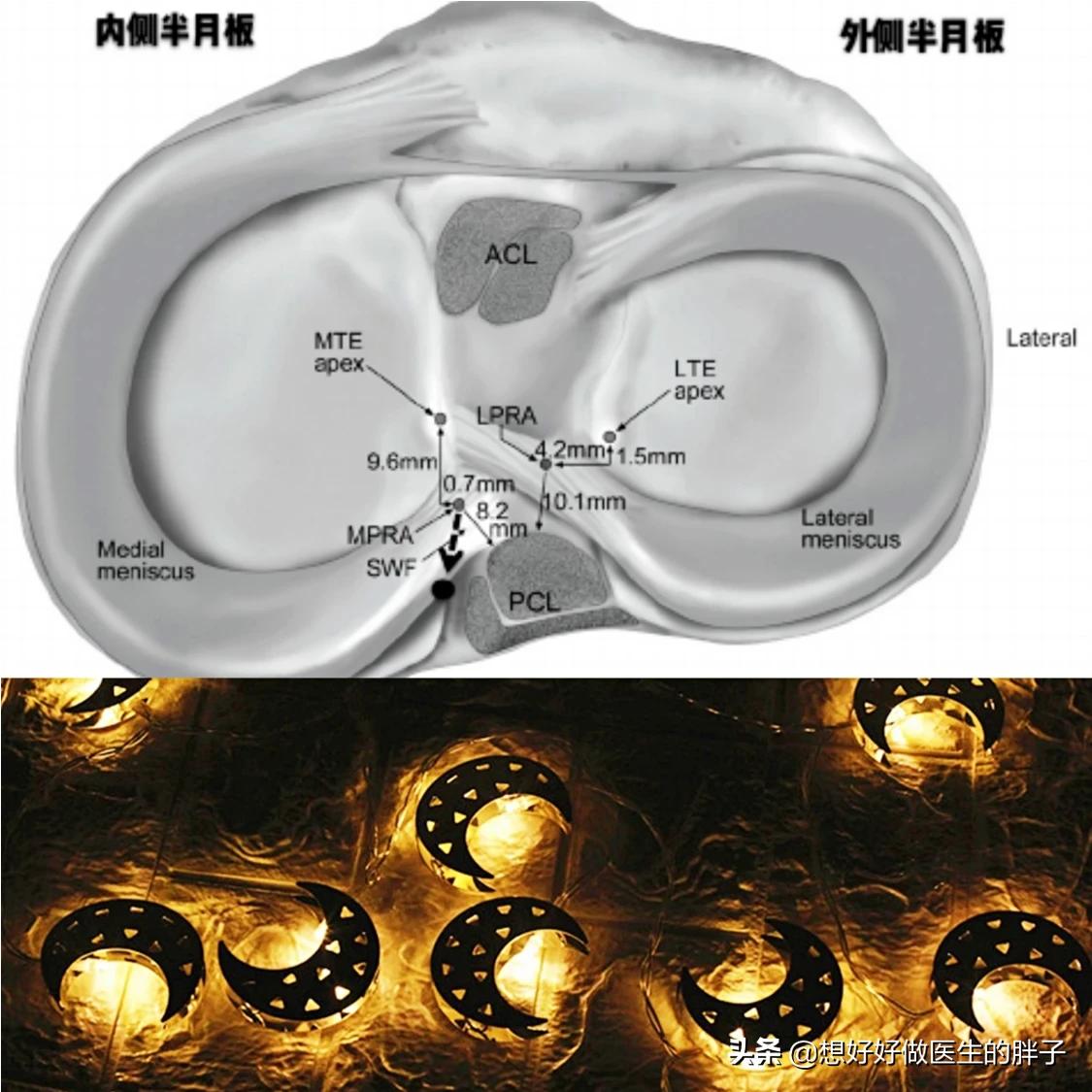 半月板损伤对足球运动员有多严重,足球运动员有半月板问题吗