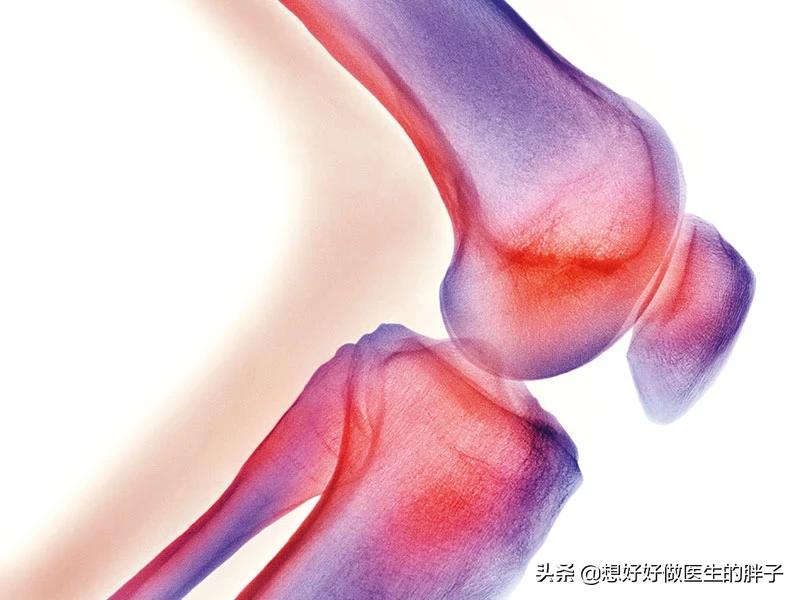 髌骨软骨损伤膝盖总是咔咔响,膝盖损伤后髌骨响是什么原因