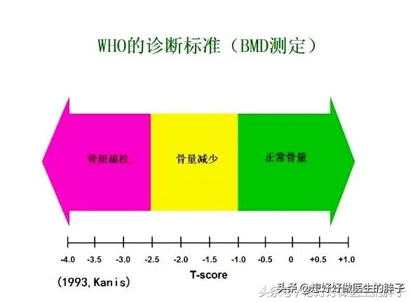 女性绝经期出现骨痛，提示可能骨质疏松了，医生教您如何系统应对