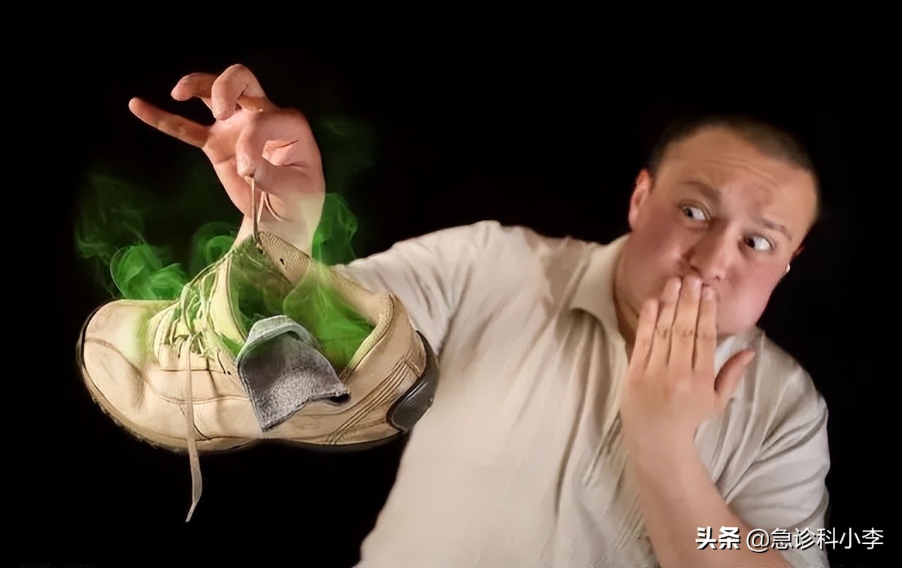 脚气反反复复怎么办？医生：教你2个实用方法，根治脚气不复发