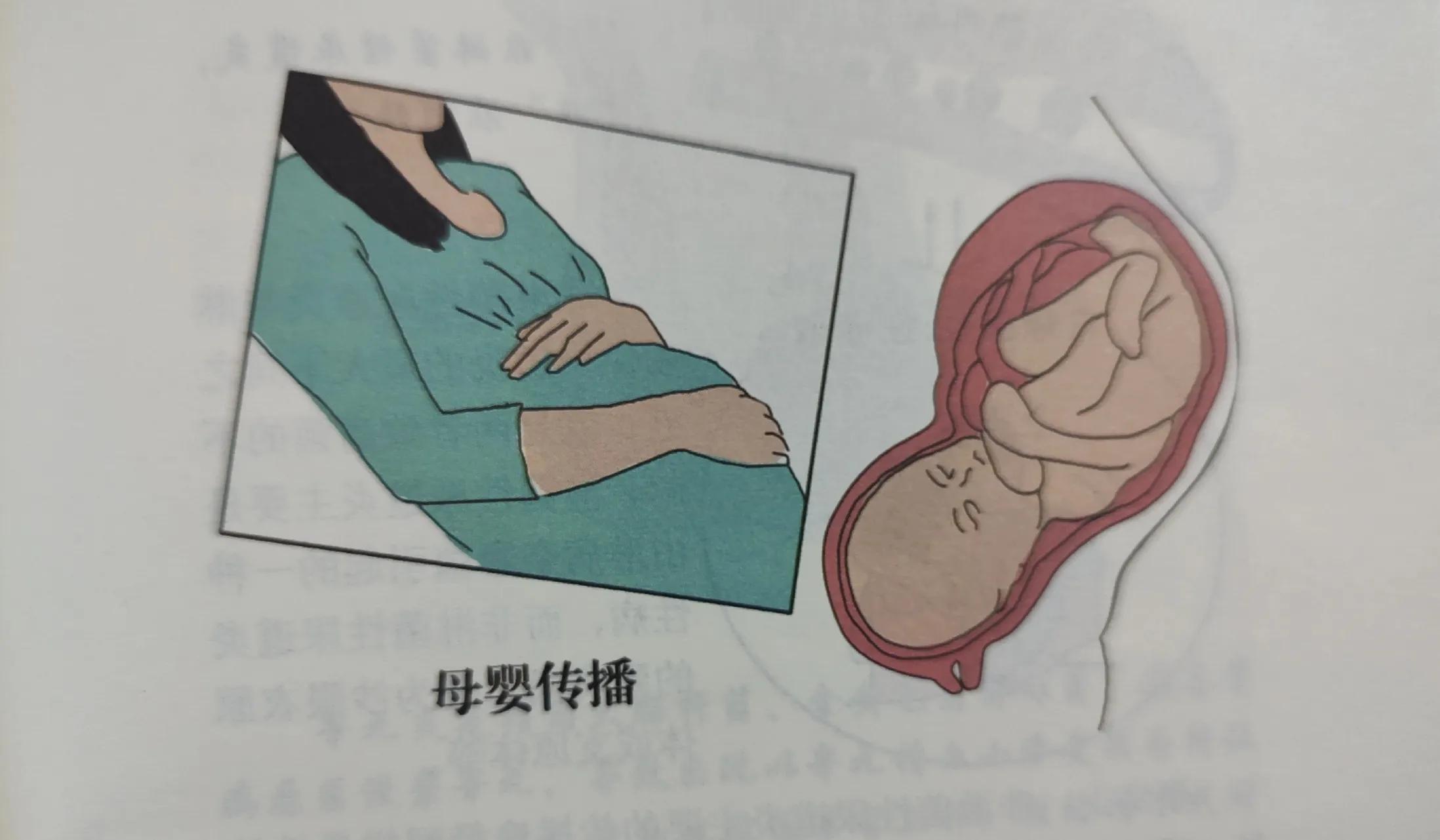 尿路感染和尿道口发炎,尿路感染有什么症状吃三金片好吗