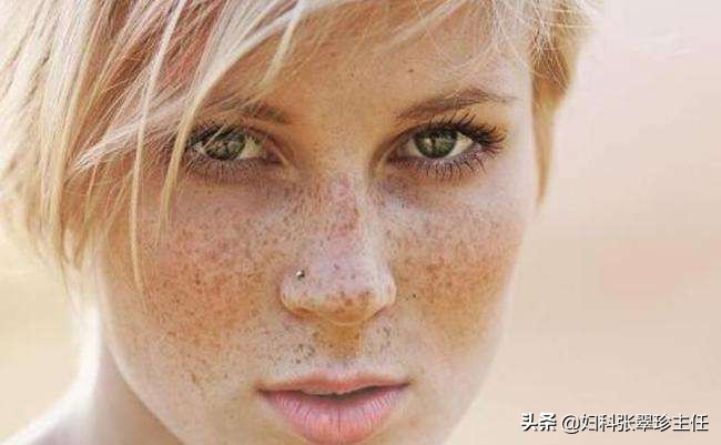女性下眼睑有黑眼圈是妇科病,眼圈出现黑色斑点是怎么了