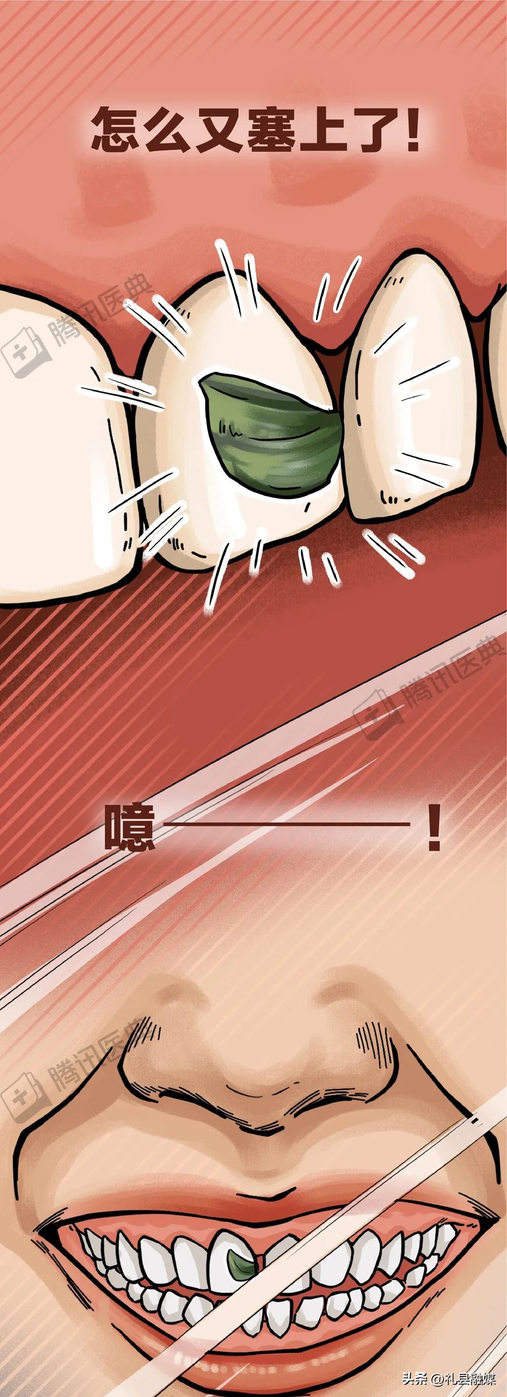 牙缝隙大吃菜就塞牙怎么修复,牙齿吃菜老塞牙怎么办