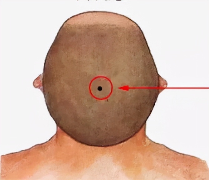 痣出现哪些变化是恶变的征兆,痣有恶变问题怎么治疗