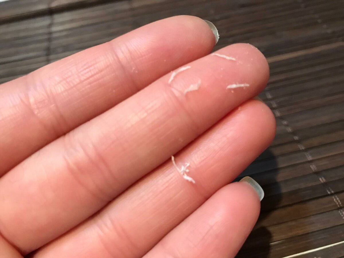 指甲渐变有条纹怎么解决,指甲薄有竖纹容易开裂不易长出来